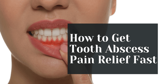 How to Get Tooth Abscess Pain Relief Fast