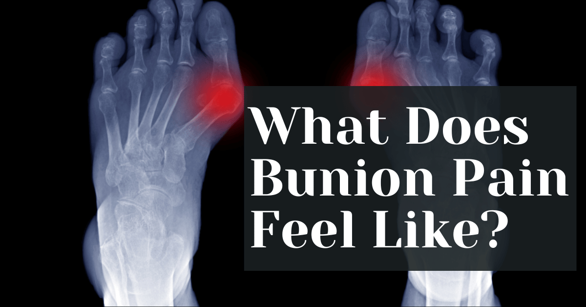 What Does Bunion Pain Feel Like? Alive Market